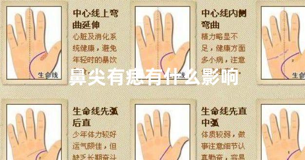 鼻尖有痣有什么影响