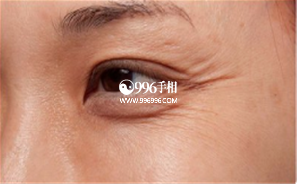 女性鱼尾纹面相图解