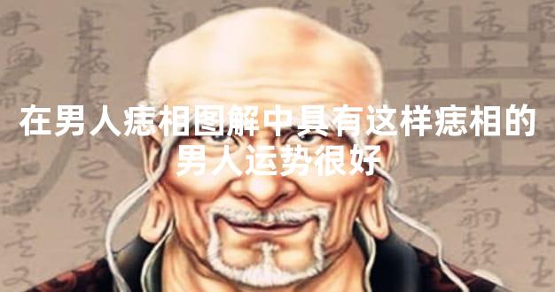 在男人痣相图解中具有这样痣相的男人运势很好