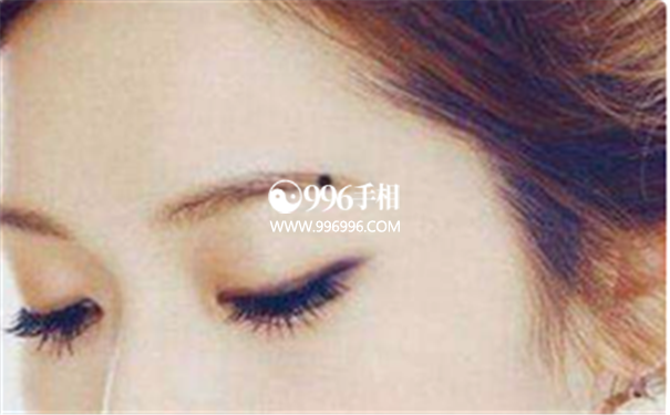 女士脸部痣图解