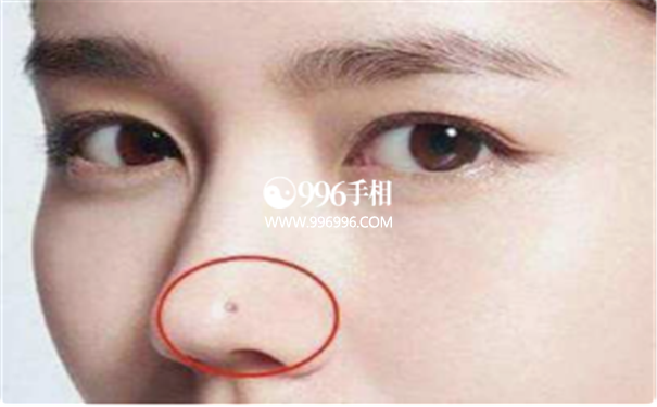 女人山根上长痣