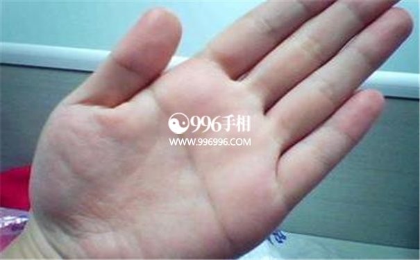 女性断掌纹
