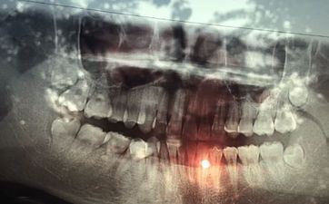 宅院种竹子的风水考究 宅院种竹子好吗