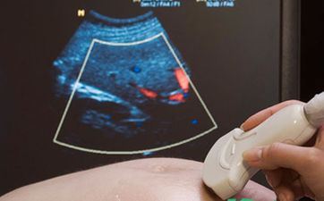 小孩取名字大全2023属兔 属兔宝宝取名字